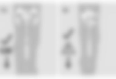 1a: Optimaler Sitz, 4a: Sitzt nicht optimal, lässt sich aber nur schwer bzw. evtl. garnicht entfernen.